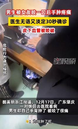 男生被女友咬一口手后疼进医院