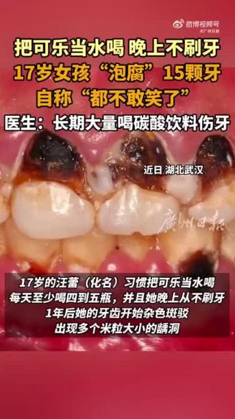 17岁女孩一天5瓶可乐泡腐15颗牙