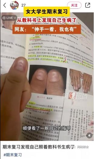 女大学生从教科书上发现自己生病了