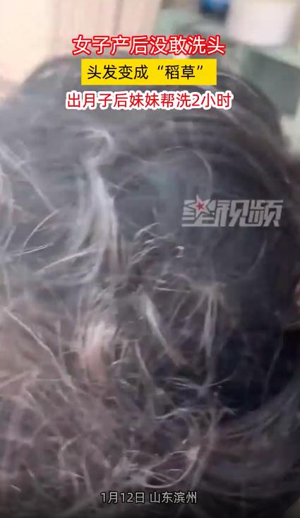 女子产后不洗头 头发变成“稻草”