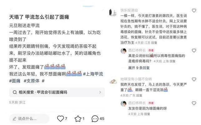 多人感染甲流后出现面瘫