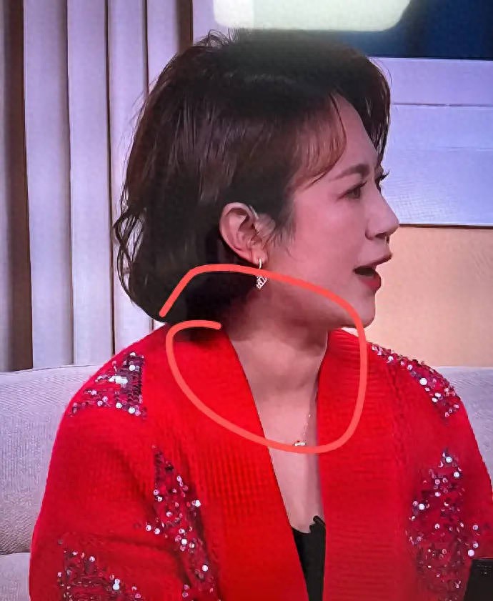 马丽被网友发现甲状腺有问题