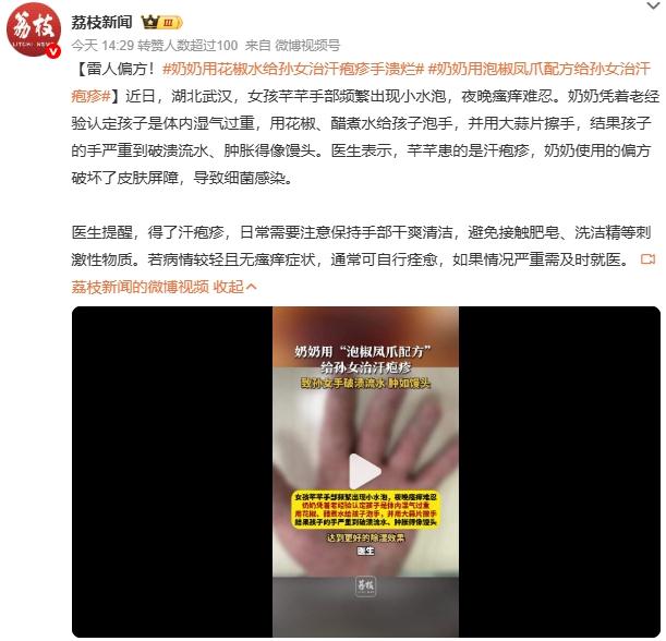 奶奶用泡椒凤爪配方给孙女治汗疱疹