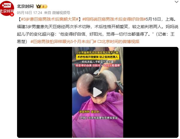 妈妈称巨痣男孩术后变得自信阳光