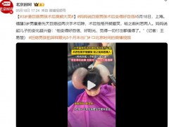 妈妈称巨痣男孩术后变得自信阳光 较之前判若两人！（图）