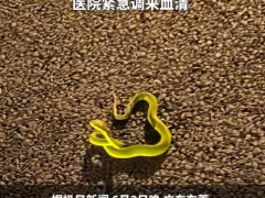男子散步被青蛇咬伤后忍痛拍照 目前黄先生伤情稳定！