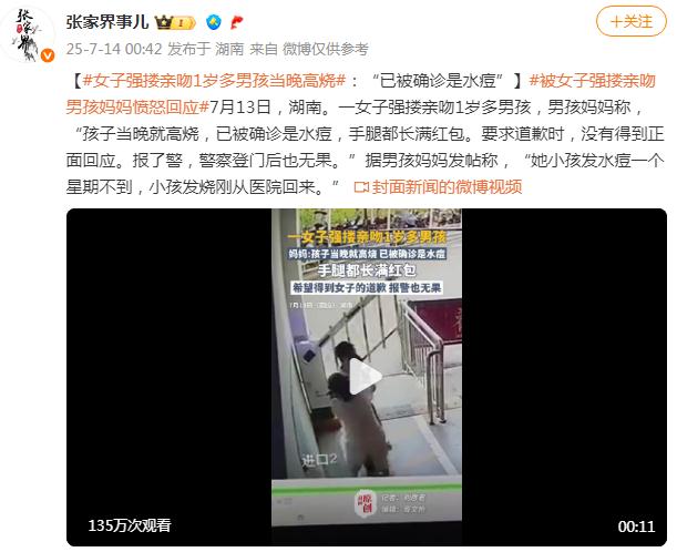 1岁男孩被女子强搂亲吻后发烧得水痘