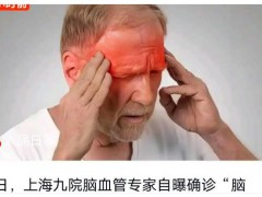 45岁三甲医院脑梗专家自己脑梗了  你为健康投入的每一分钟，都在为生命增加筹码！