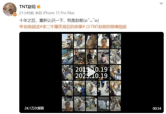 演员赵荀公布重伤十年治疗画面