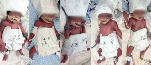 24岁女子成功诞下5胞胎