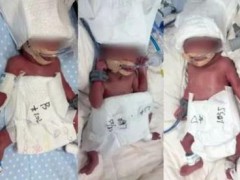 太牛！24岁女子成功诞下5胞胎 网友：这是开了“复制粘贴”模式？